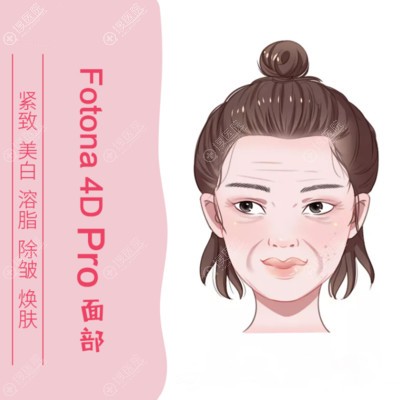 欧洲之星fotona4d面部提升效果如何?做一次的价格贵吗
