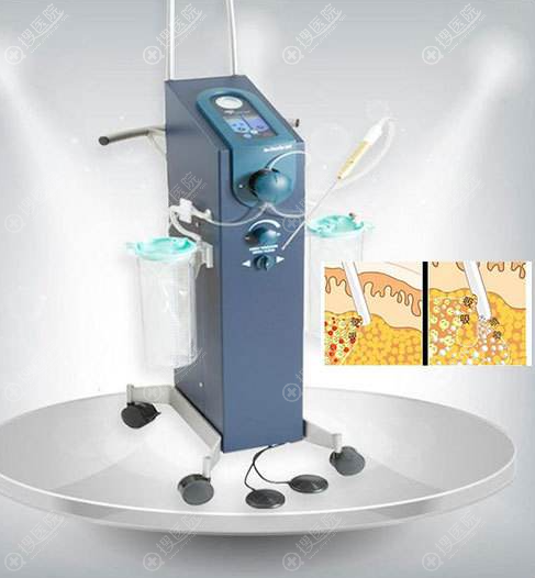 �˽⵽��ˮ������֬�ݴ�����ʹ�ȵ�Ч�����ã�һ����Ҫ����Ǯ��