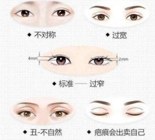 双眼皮二次三次修复是有风险的,重新做的话成功率高吗?
