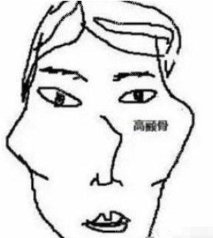 不开刀微创降颧骨多少钱?手术费用及效果证明既安全又靠谱