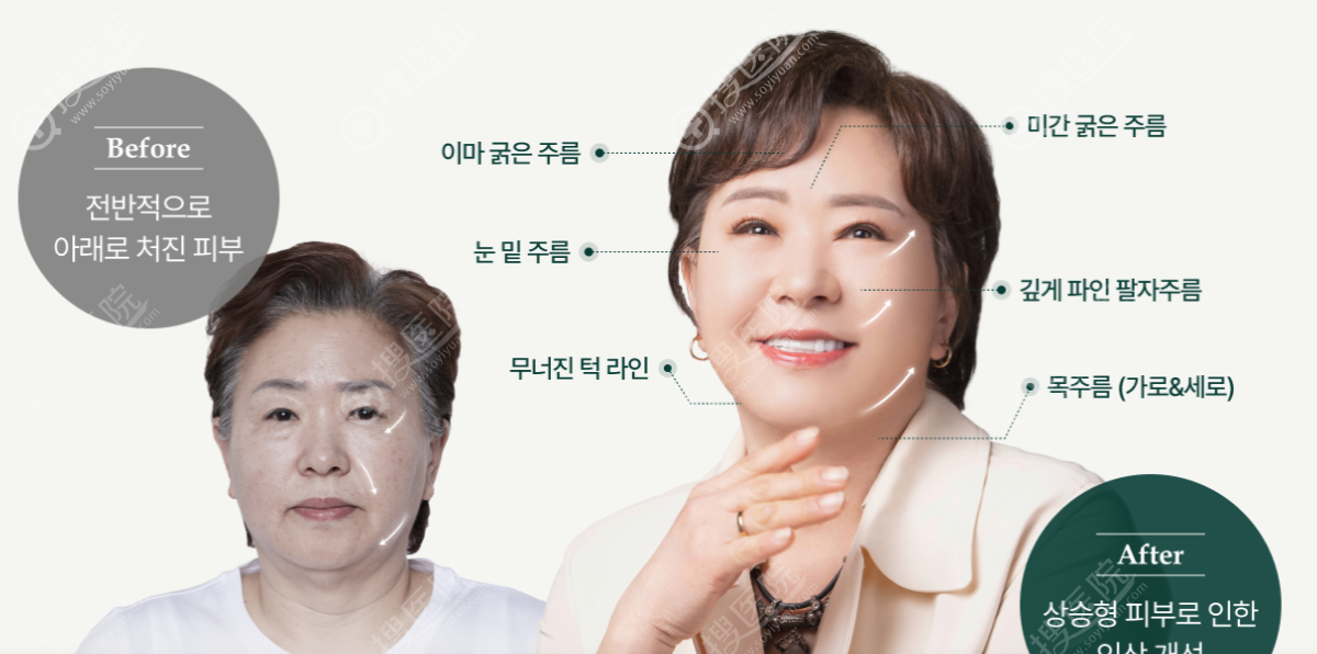 如何預約釜山麗婷整形外科? 如何預約釜山麗婷整形外科?