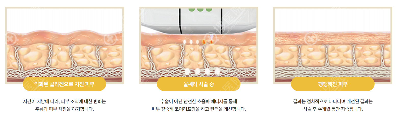 仁川 PARKVIEW 皮膚科的服務細節與反饋 仁川 PARKVIEW 皮膚科的服務細節與反饋