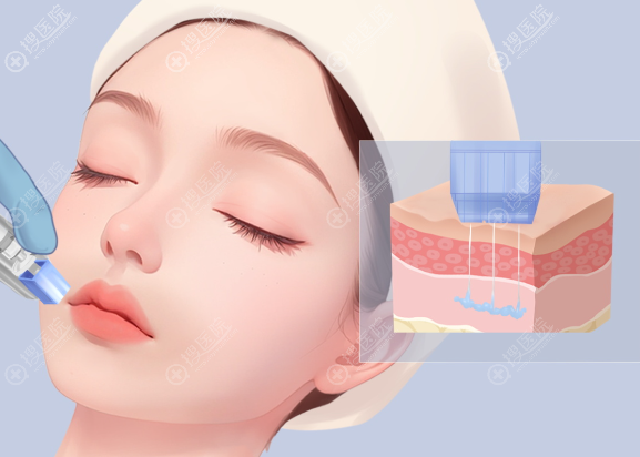 �n��ARTLINEƤ�w�����tԺ�r��ͷ���