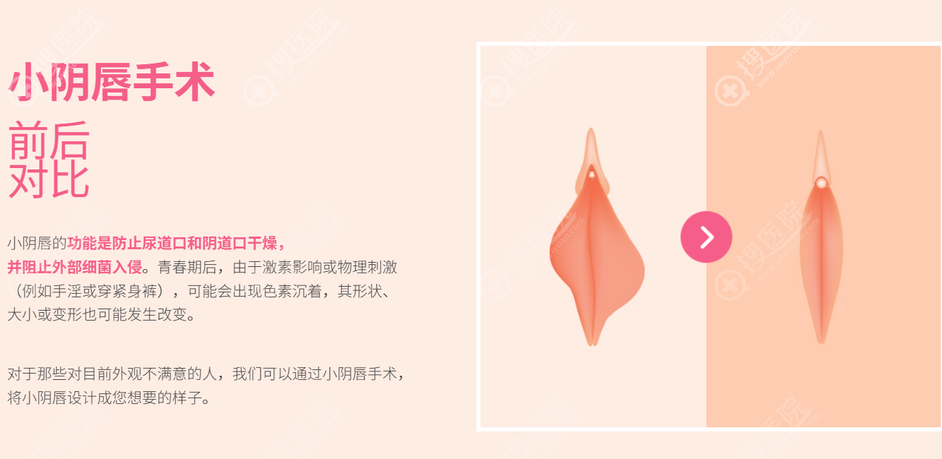 韓國 S 女性醫院 韓國 S 女性醫院