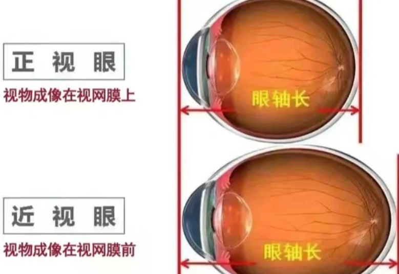 �塢�挍�ڱ��u�r���W�����N�f��