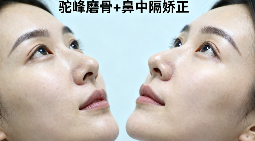 四、台灣客人高回訪率是真的嗎?從術前到術後的全流程體驗揭秘