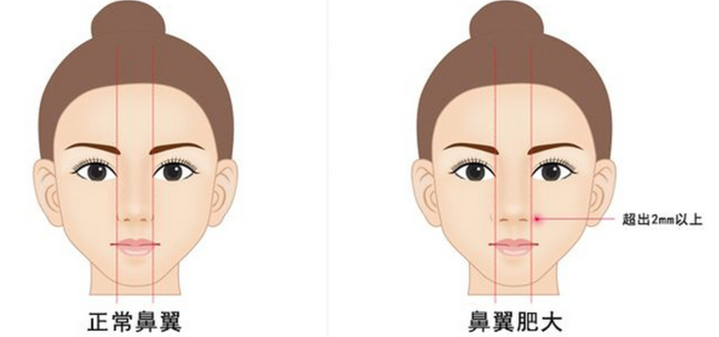 二、價格真的落在800-1200萬韓元嗎?費用透明度和隱藏成本說清楚