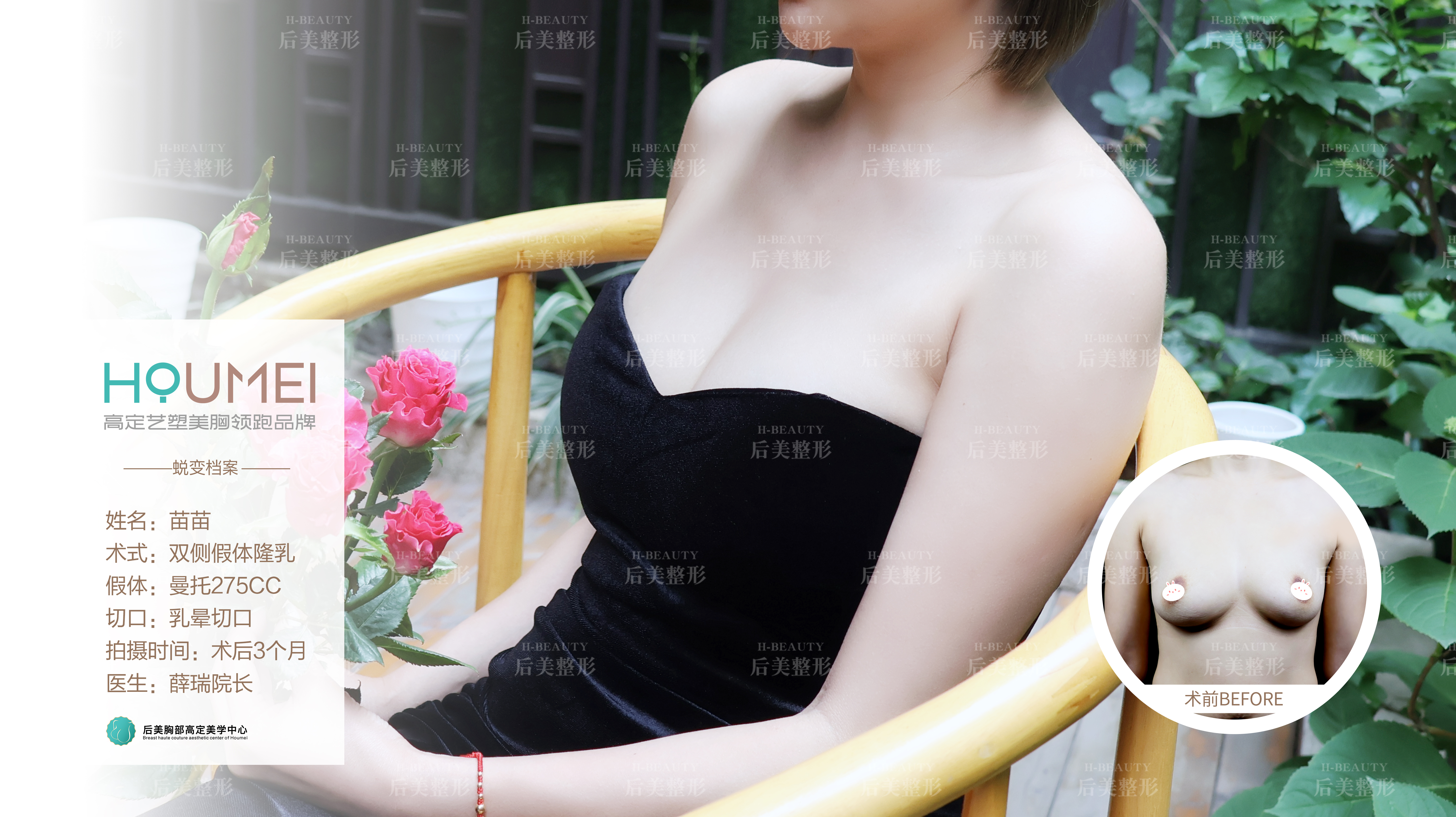 一、成都高新后美医疗美容医院为什么近几年讨论度上升?