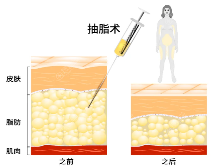 20260518_1779074932544089.png image.png
