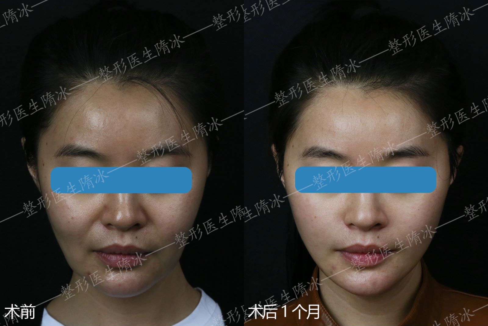 二、 北京子彦丽格医疗美容诊所主推医生团队:一位院长,一个技术灵魂