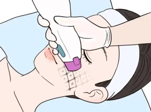 三、韓國onecell皮膚科美超验真方法与安心确保细节