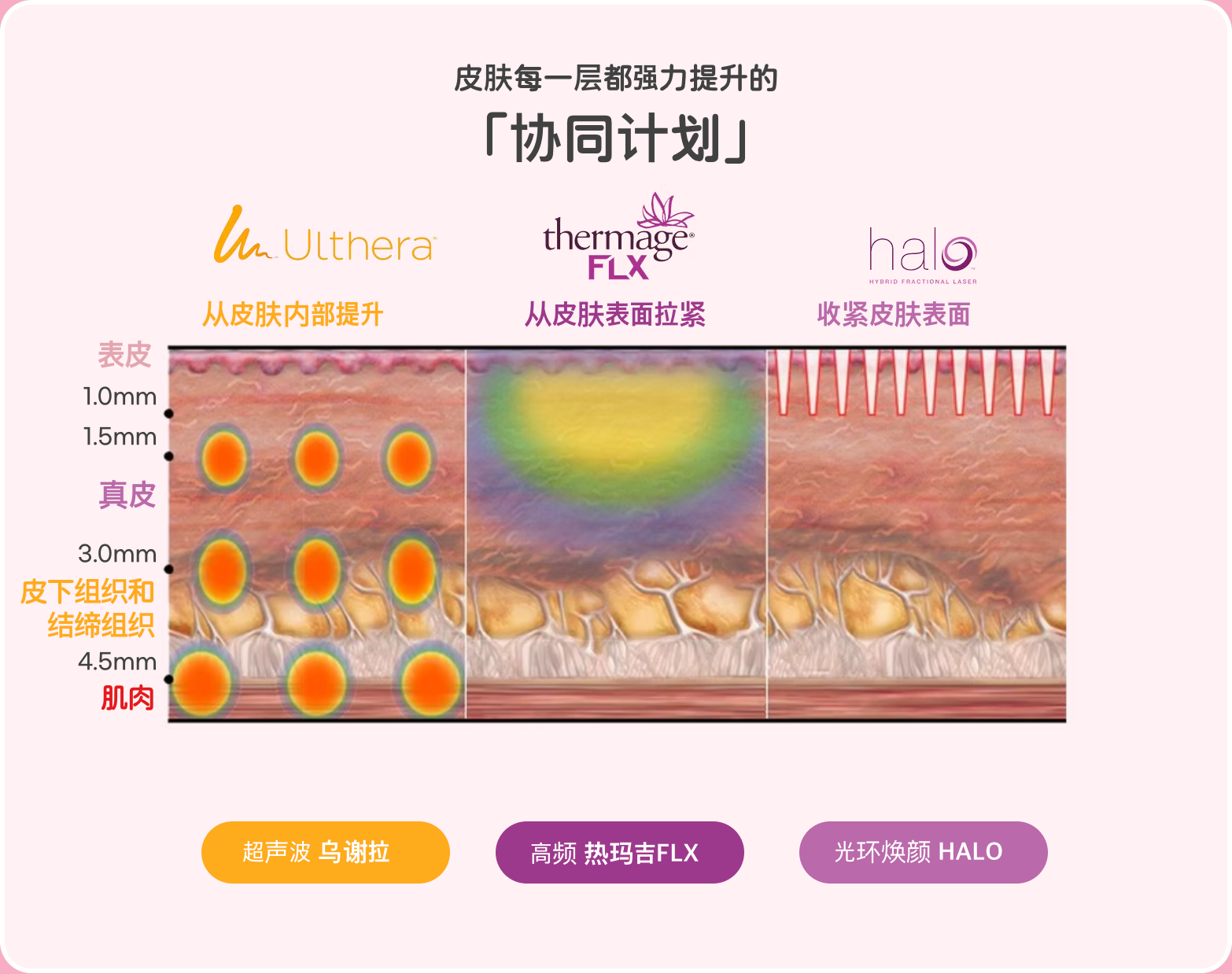 ���ݍuThe LiftƤ�w�����������u�r�����H�yXerf����һ�����o�@�pЧ��һ̫���ˣ�