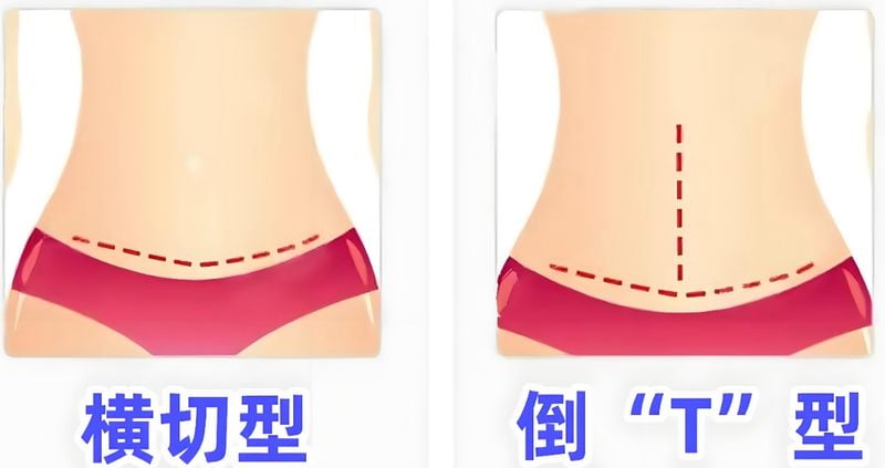 一、李献和个人资料全览——用可核验的硬信息回答