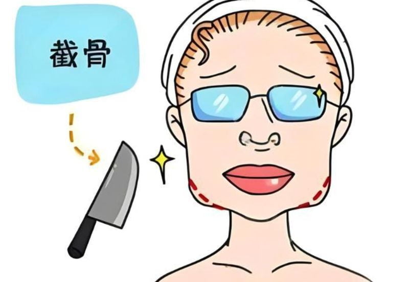 一、西安国际医学籍建华面部轮廓怎么样