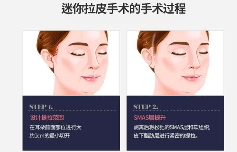 被夸得较多的点