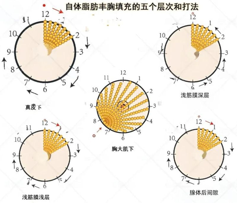 ▎鼻综合整形与颌面轮廓