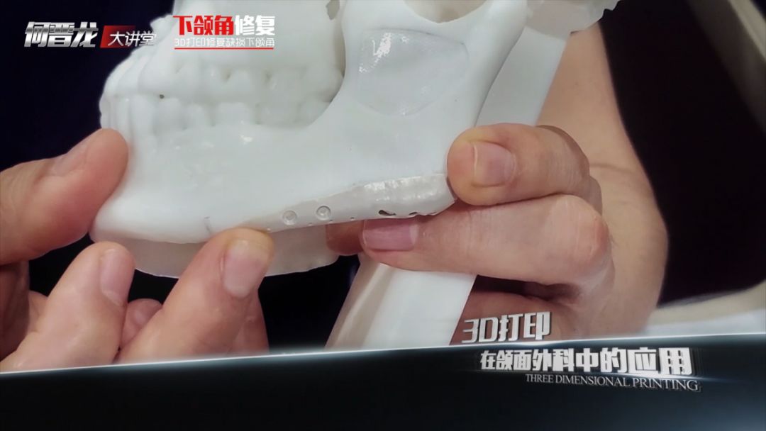 上海时光何晋龙正颌磨骨