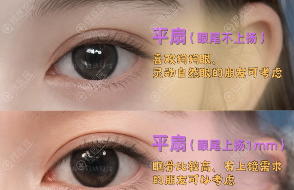 武汉王海平做上睑下垂好吗? 武汉王海平做上睑下垂好吗?