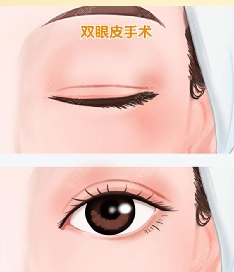1. ���ù����ƶ��˳���