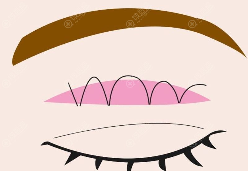 3. �Բ������뽵���޸�