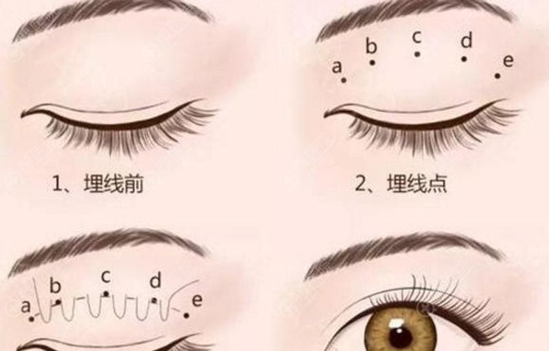 4. �����´�����