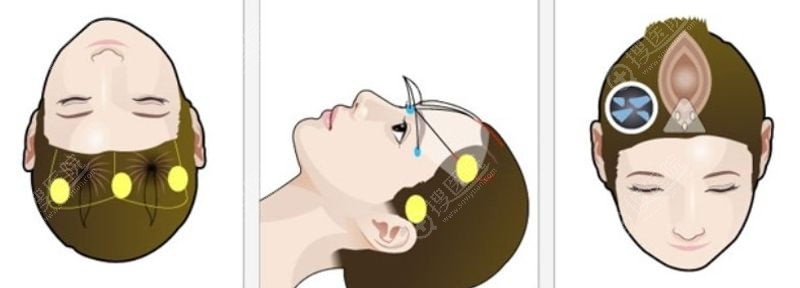 2. 完备的麻醉医师团队常驻