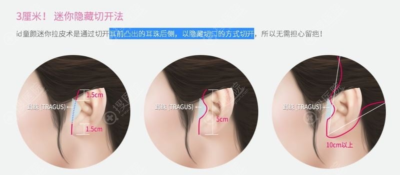 3. 高精尖医疗设备的重投入