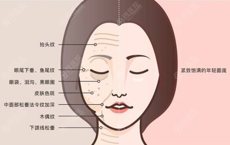 2. 面部除皱术(传统与现代技术的融合)