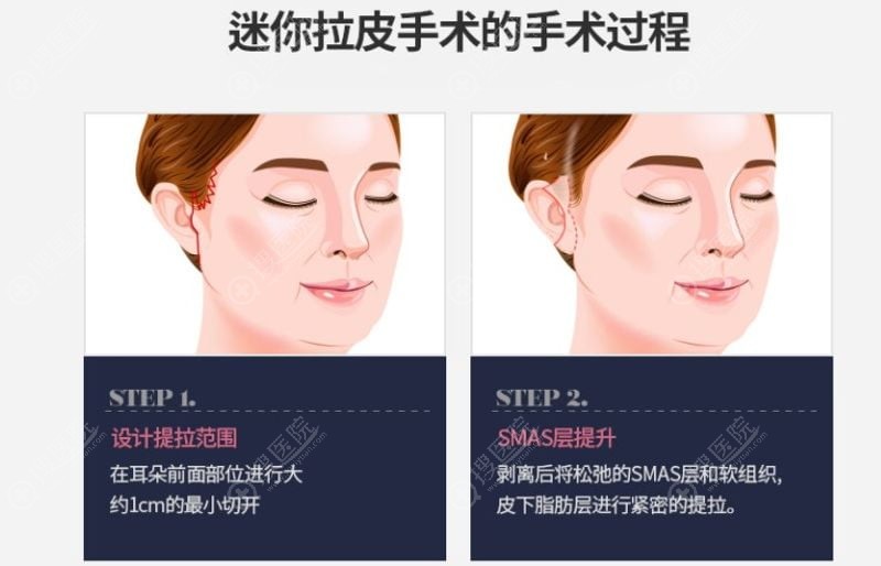 3. 极高的话事权与修复实力