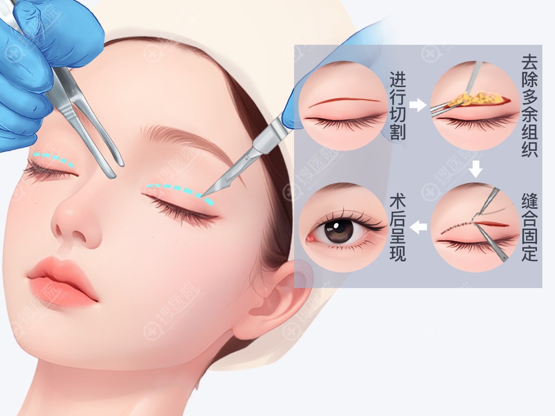 为什么找刘佳亮医生,一定要用美卫士APP/小程序打辅助? 为什么找刘佳亮医生,一定要用美卫士APP/小程序打辅助?