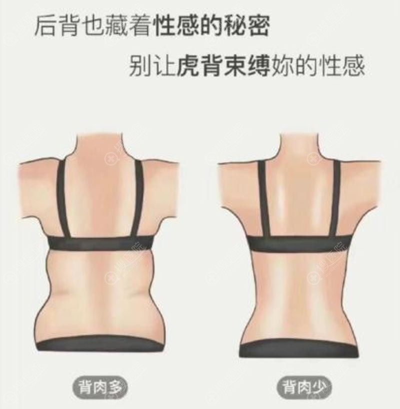 3. “克制”的审美,拒绝工业化网红脸