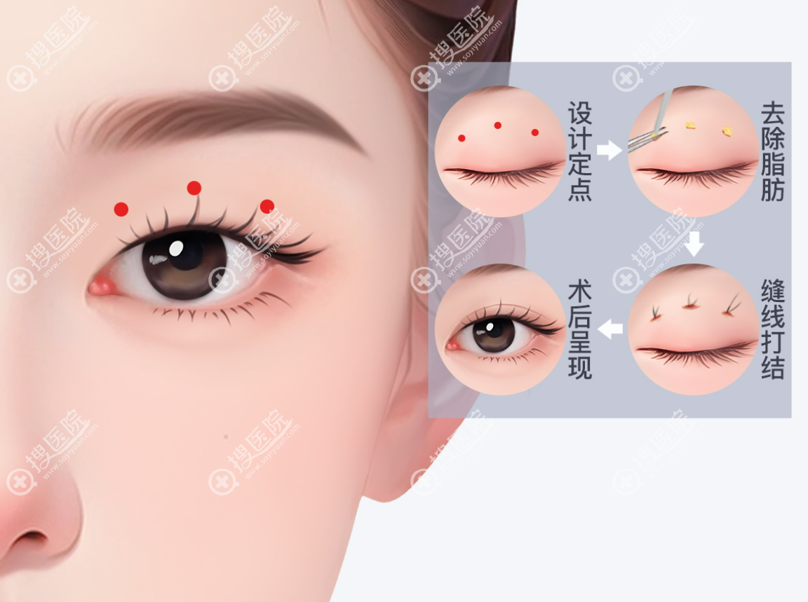 北京丰联丽格师丽丽怎么预约 北京丰联丽格师丽丽怎么预约