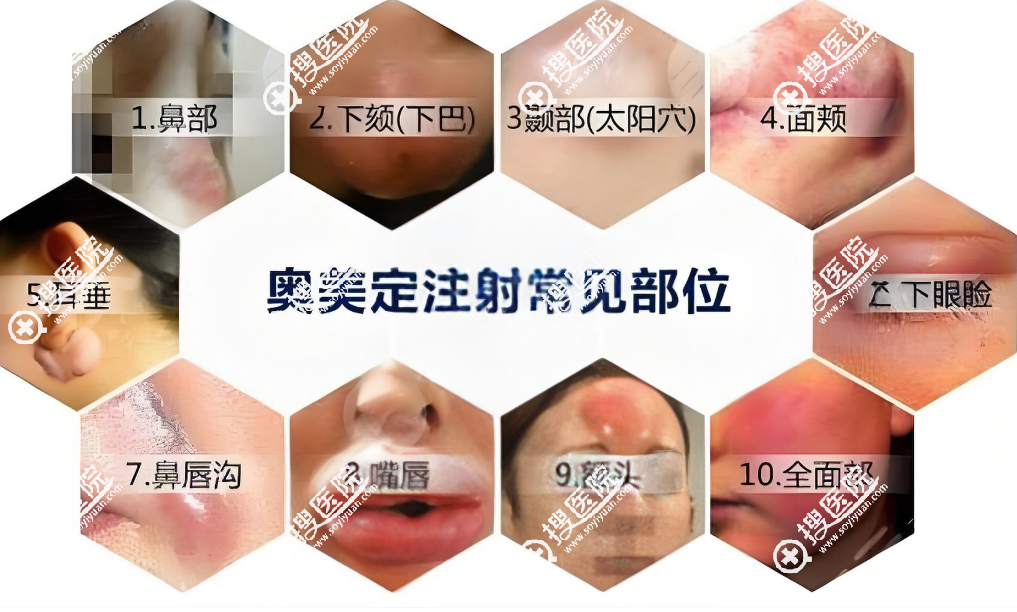 北京煤医周云超异物取出怎么预约 北京煤医周云超异物取出怎么预约