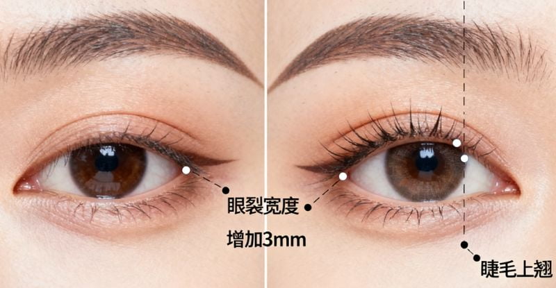一、广州张伟院长双眼皮技术怎么样?深入解析其核心优势
