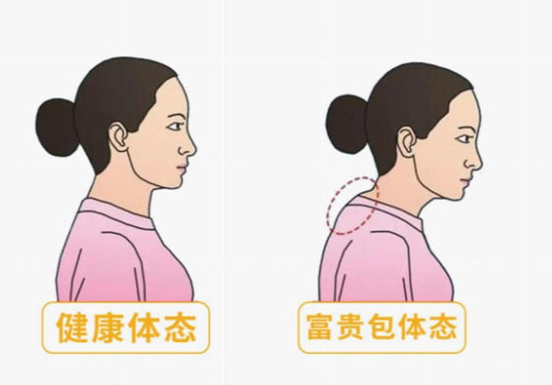 四、富贵包治疗前你必须明白的几件事