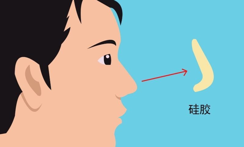 三、找张辉做修复前必须了解的关键点