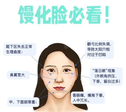 曾德浩修复馒化脸腻害 曾德浩修复馒化脸腻害