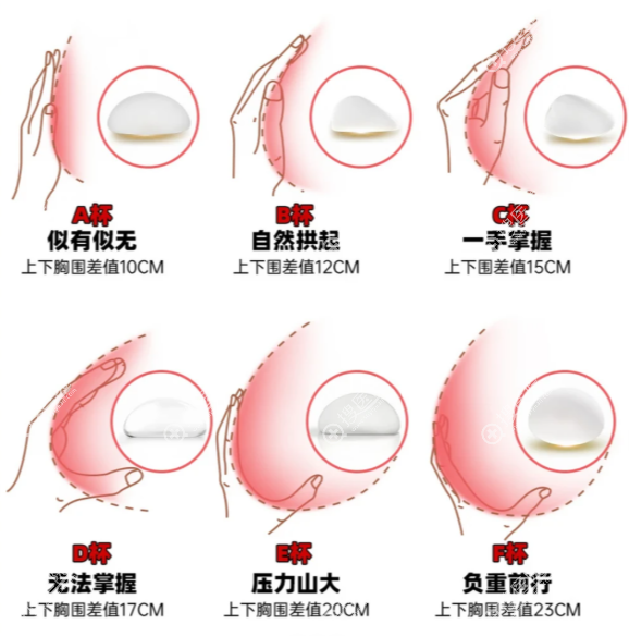 唐毅隆胸 唐毅隆胸
