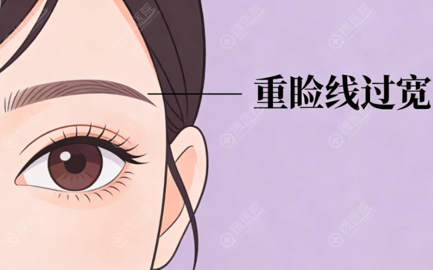 关于房红超双眼皮的那些大实话 关于房红超双眼皮的那些大实话