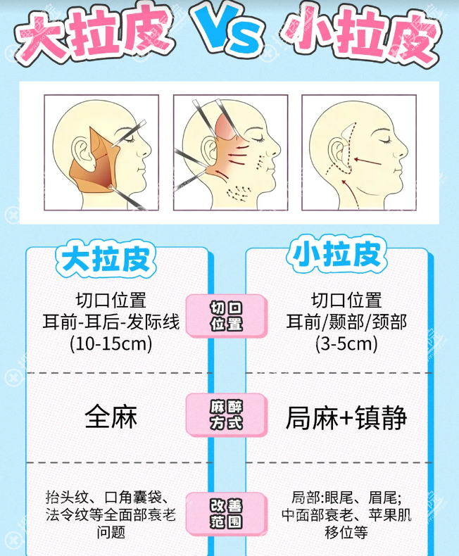朱立德小拉皮手术 朱立德小拉皮手术