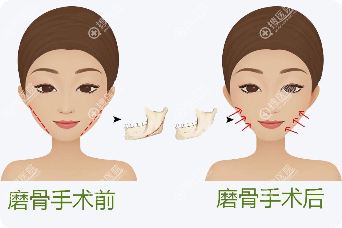 上海韦敏磨骨怎么样?有哪些硬核招牌? 上海韦敏磨骨怎么样?有哪些硬核招牌?