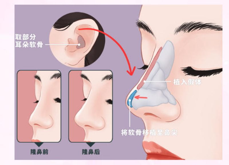 二、肖阿能擅长项目