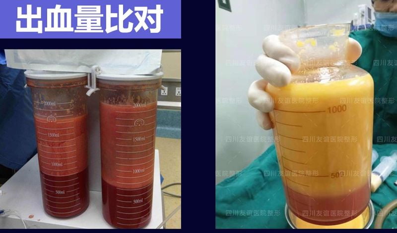 �ɶ�ƽ��ҽԺ��־����֬���