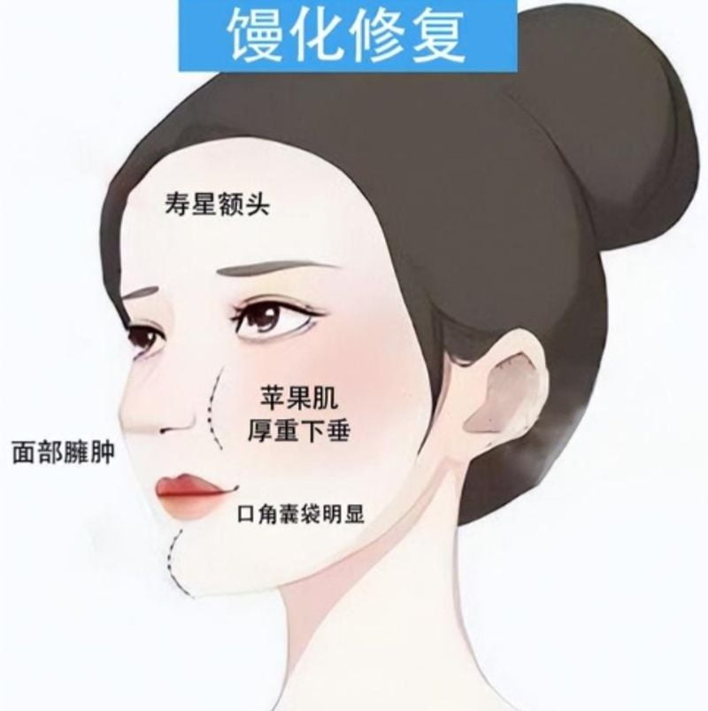 三、上海艺星杜亚如注射收费与价格参考——你需要知道的
