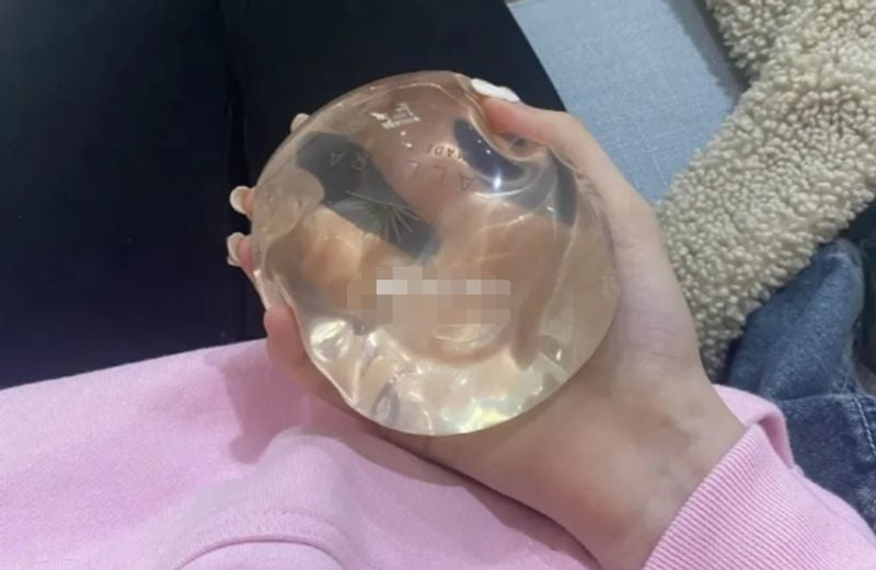 王博谦核心项目一:内窥镜辅助隆胸与艺星舒适丰胸——差别不在
