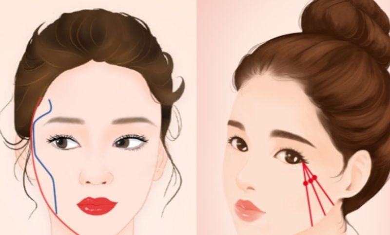 一、朴相薰是誰?——不是「網紅醫生」,是顱顏骨外科出身