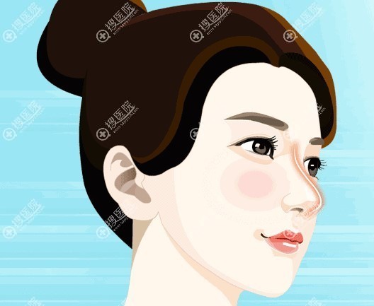 郑东学鼻整形 郑东学鼻整形
