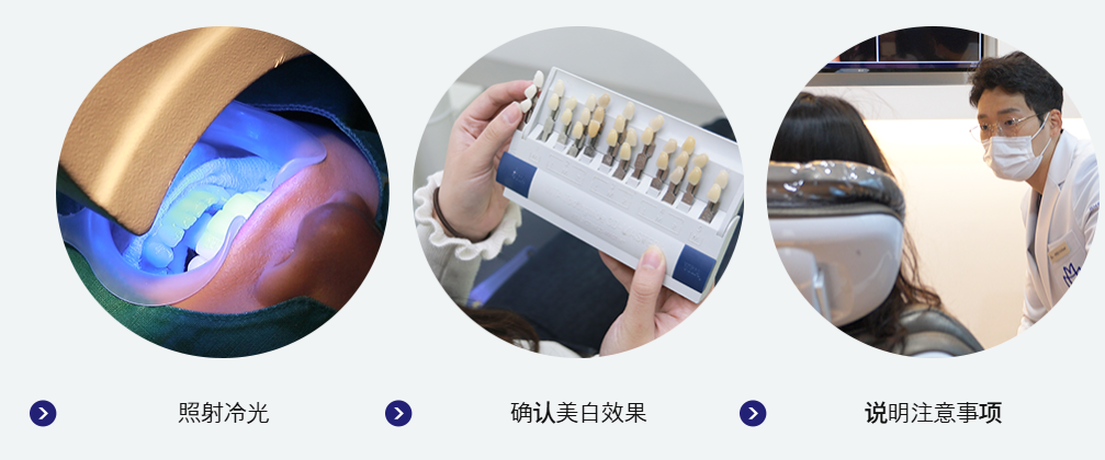 韓國 Minish 牙齒貼面 (貼片)|超薄微創技術單顆 3500
