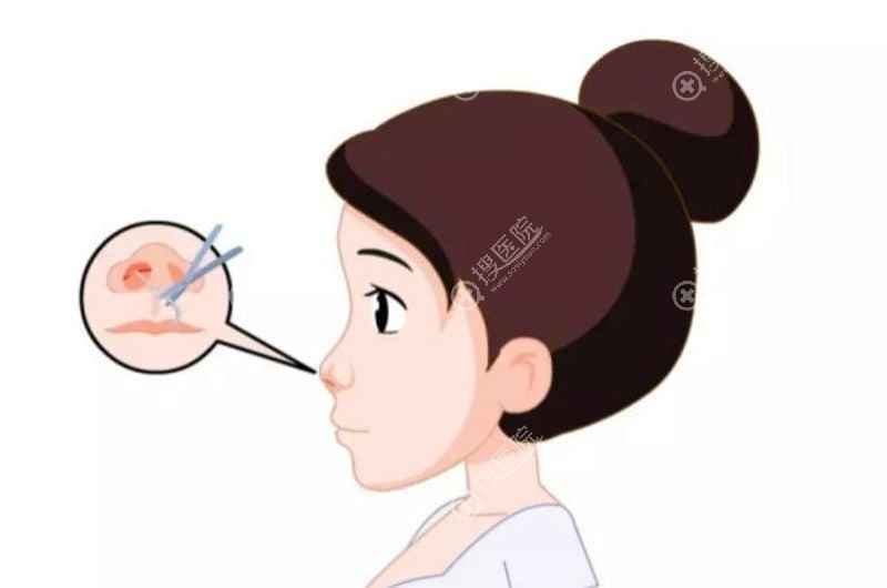 三、如何判斷自己的情況是否屬於「高難度修復」?