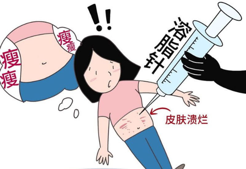 二、 李钢特色项目:脂肪填充与面部吸脂的技术逻辑